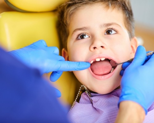 Dentist examining smile after placing tooth colored fillings for children