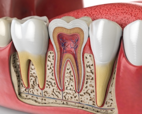 Animated smile before root canal therapy