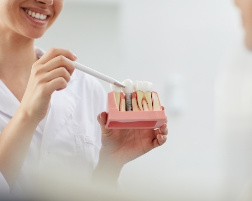 Dentist pointing to model of dental implant supported replacement tooth